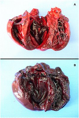 <mark class="highlighted">Heartworm</mark> Disease (Dirofilaria immitis) in Two Roaming Dogs From the Urban Area of Castel Volturno, Southern Italy